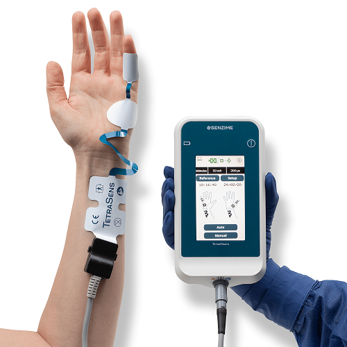 Monitoring neuromuskularne blokade