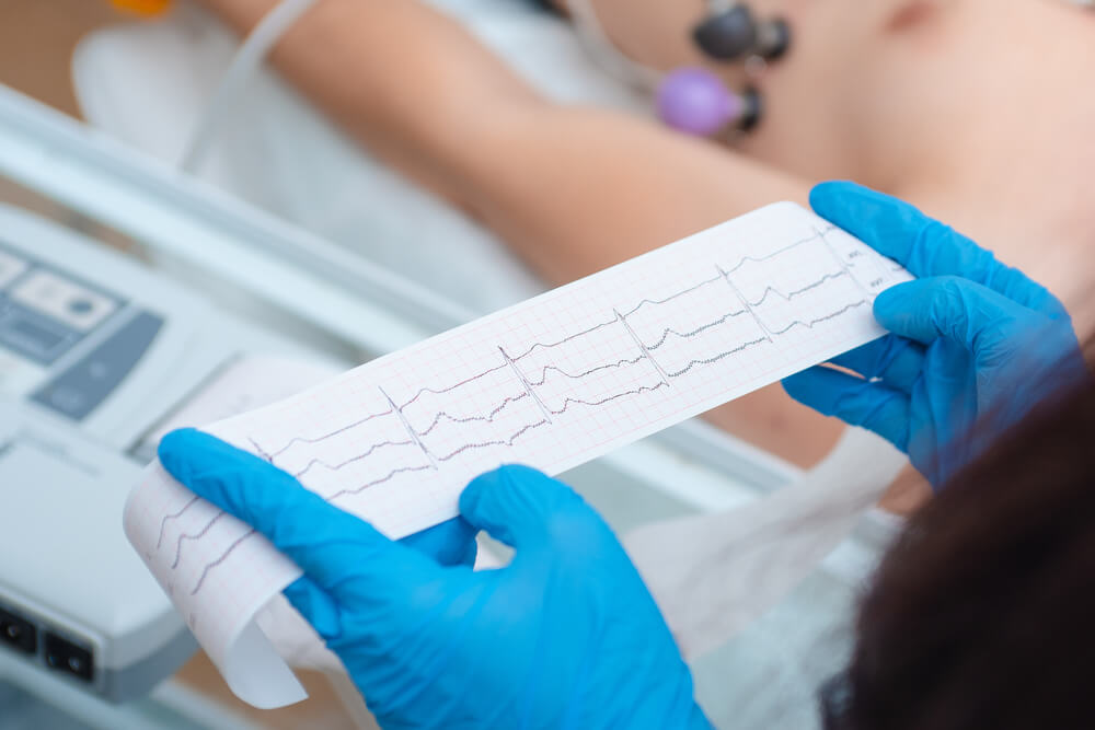 EKG aparati