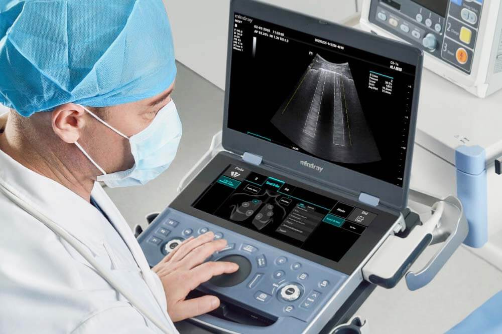 Prenosni ultrazvučni aparat