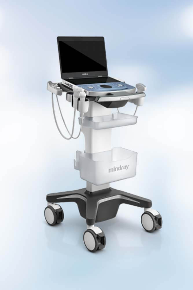 Prenosni ultrazvučni aparat