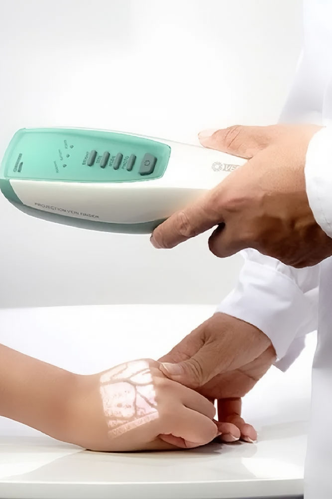 uređaj za detekciju vena