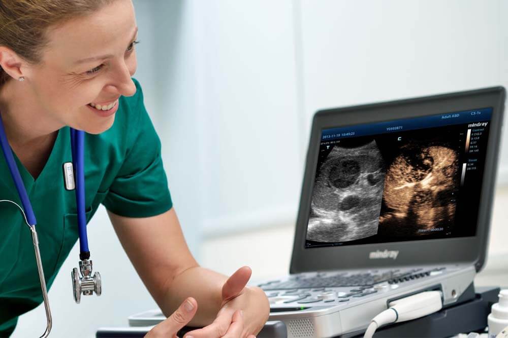 Medicinska oprema za radiologiju