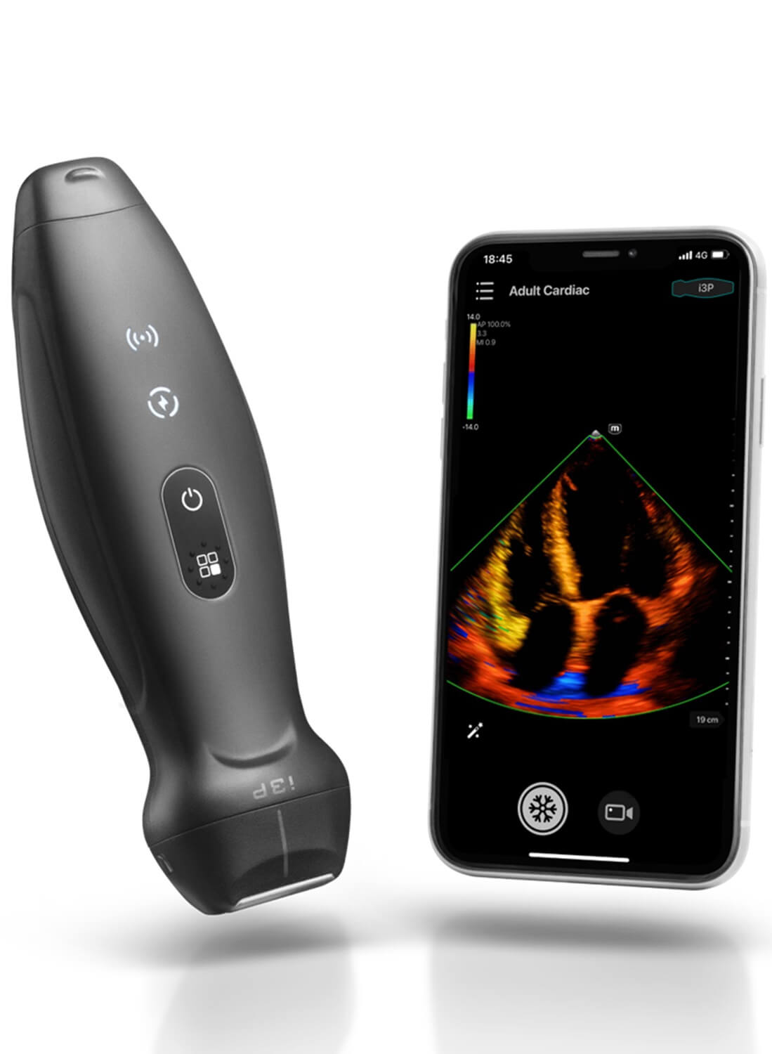 Ručni bežični ultrazvuk 