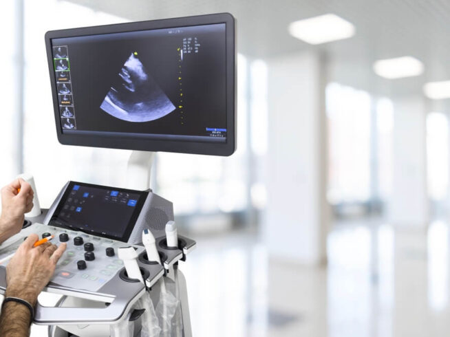 Ručni bežični ultrazvuk