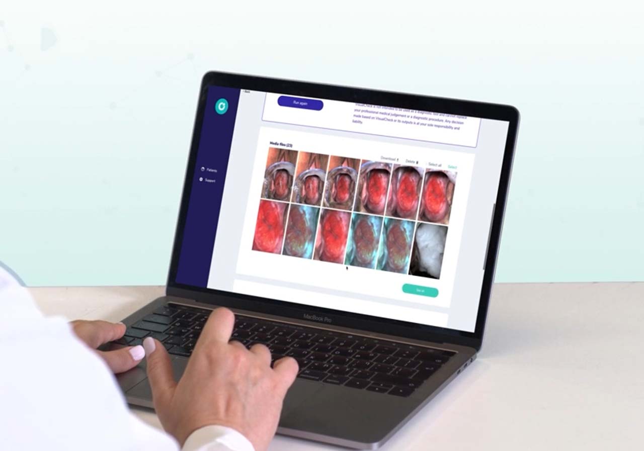 Digitalni mobilni kolposkop 