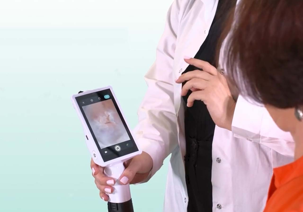 Digitalni mobilni kolposkop 